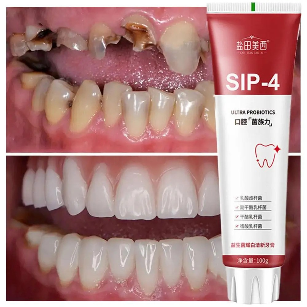 SIP-4 Whitening Probiotic Toothpaste | Care for a Bright Smile and Fresh Breath